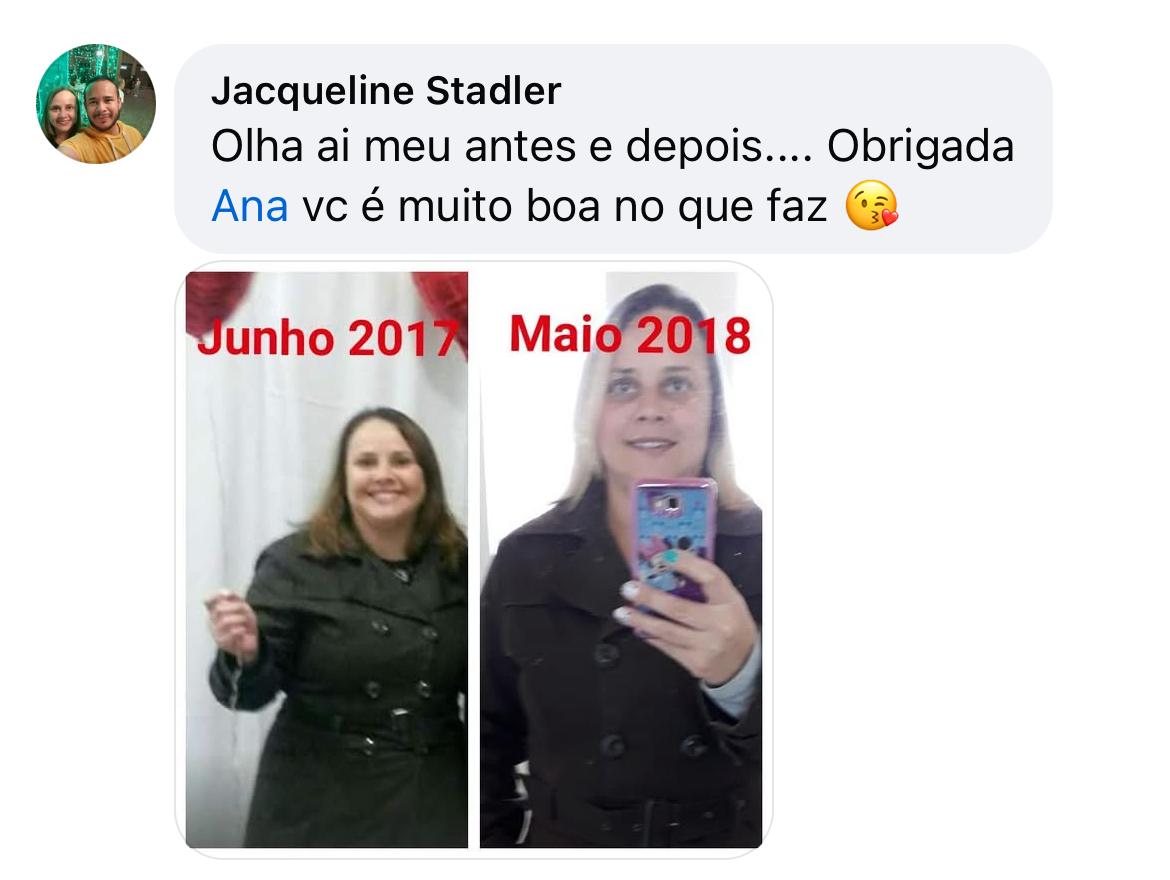 Comentário de Jacqueline Stadler com seu antes e depois, de junho de 2017 a maio de 2018: Obrigada Ana, você é muito boa no que faz.